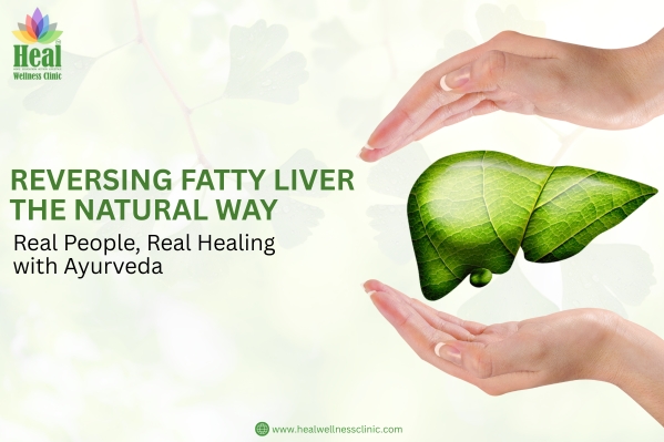 Reversing Fatty Liver the Natural Way: Real People, Real Healing with Ayurveda